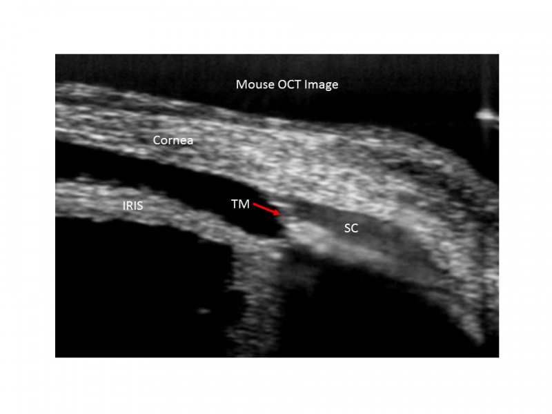 Stamer Lab Images Duke Department Of Ophthalmology